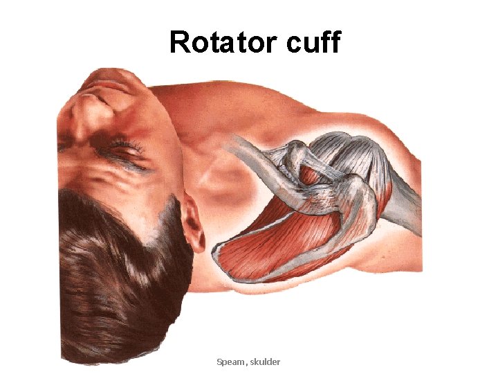 Rotator cuff Speam, skulder 