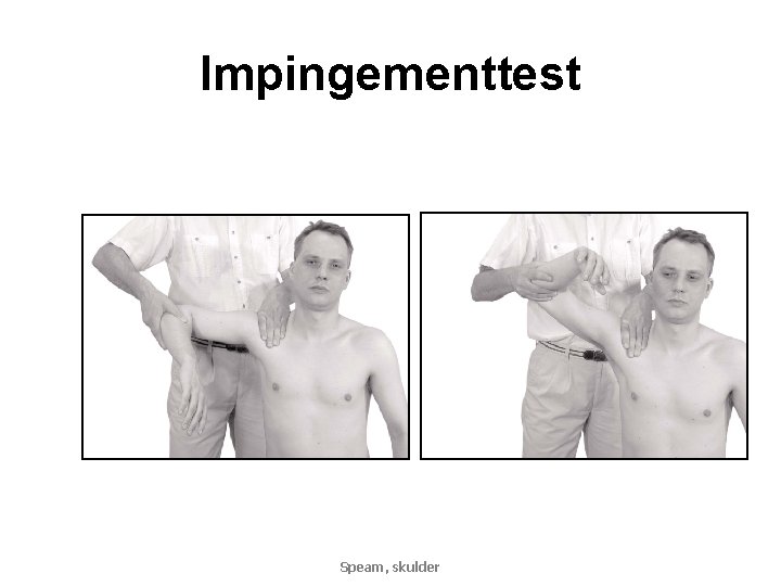 Impingementtest Speam, skulder 
