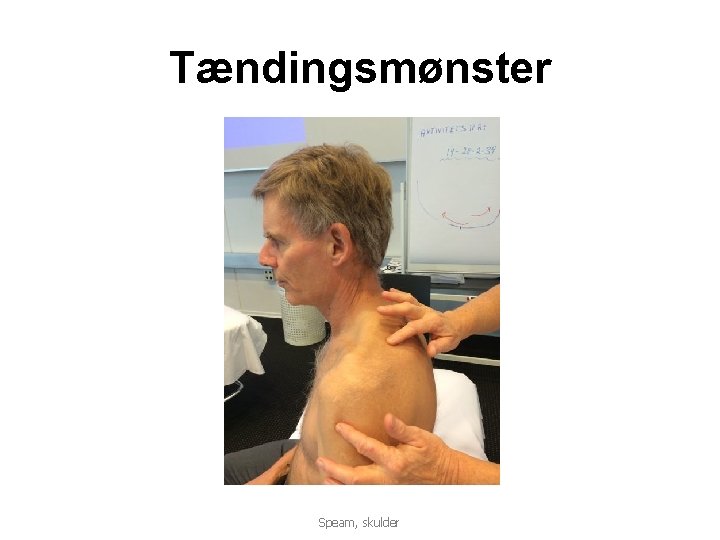 Tændingsmønster Speam, skulder 