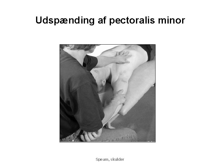 Udspænding af pectoralis minor Speam, skulder 