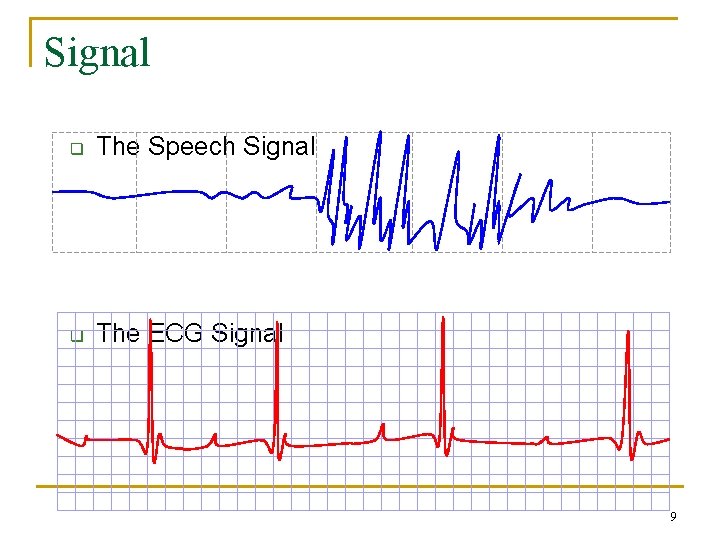 Signal q The Speech Signal q The ECG Signal 9 