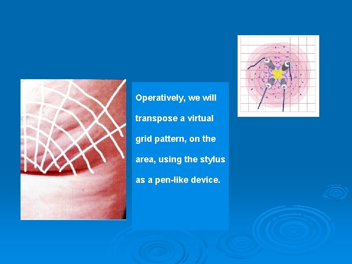 Operatively, we will transpose a virtual grid pattern, on the area, using the stylus