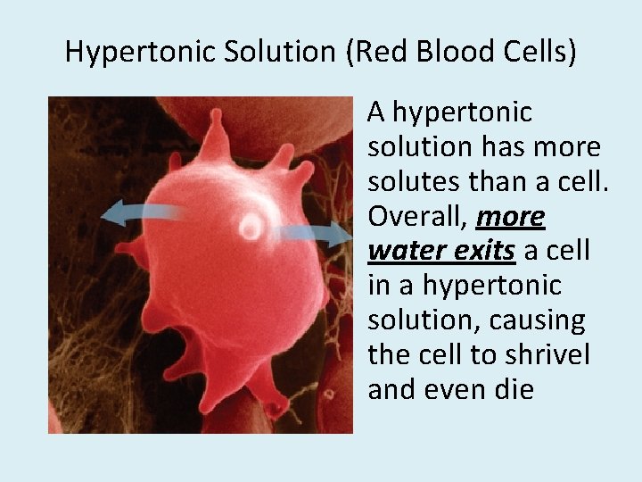 Hypertonic Solution (Red Blood Cells) A hypertonic solution has more solutes than a cell.