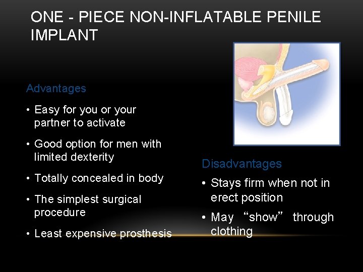 ONE - PIECE NON-INFLATABLE PENILE IMPLANT Advantages • Easy for your partner to activate