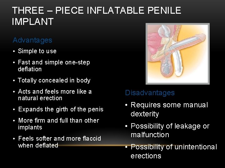 THREE – PIECE INFLATABLE PENILE IMPLANT Advantages • Simple to use • Fast and