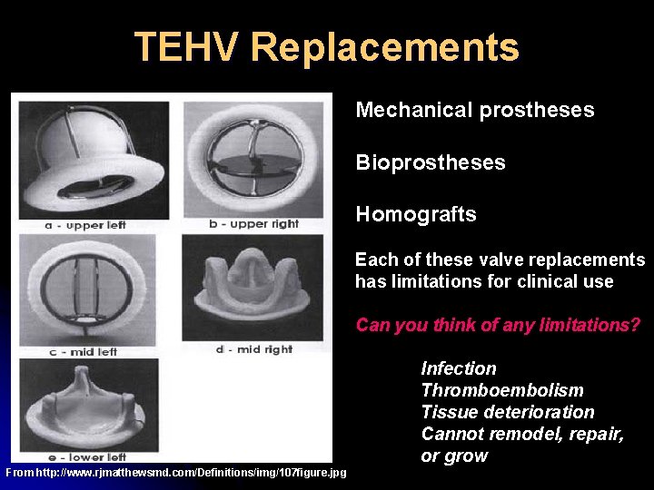 TEHV Replacements Mechanical prostheses Bioprostheses Homografts Each of these valve replacements has limitations for