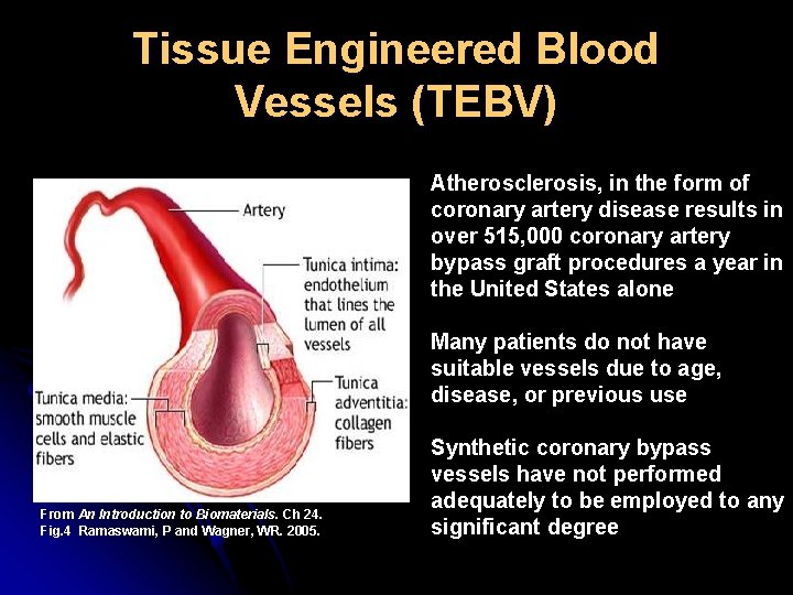 Tissue Engineered Blood Vessels (TEBV) Atherosclerosis, in the form of coronary artery disease results