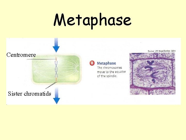Metaphase Centromere Sister chromatids Metaphase Centromere Sister chromatids