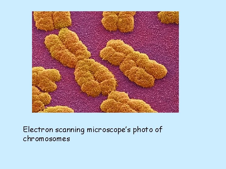 Electron scanning microscope’s photo of chromosomes Electron scanning microscope’s photo of chromosomes