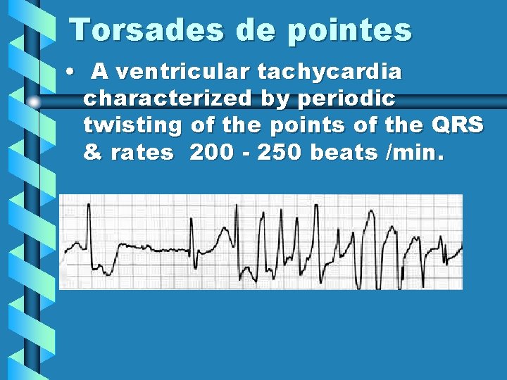 Torsades de pointes • A ventricular tachycardia characterized by periodic twisting of the points