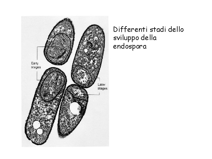 Differenti stadi dello sviluppo della endospora 