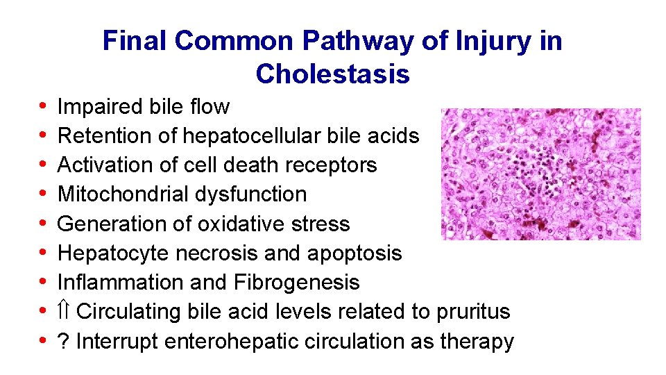 Final Common Pathway of Injury in Cholestasis • • • Impaired bile flow Retention