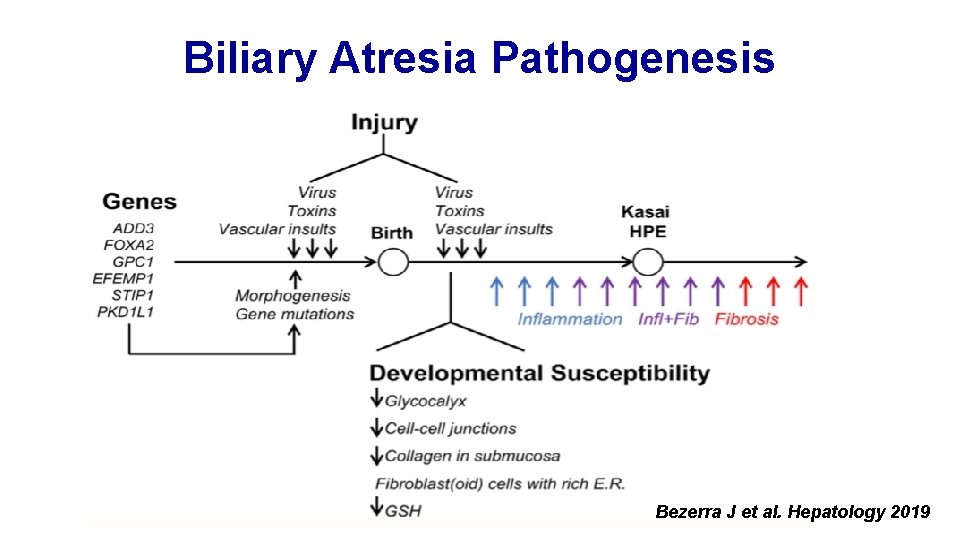 Biliary Atresia Pathogenesis Bezerra J et al. Hepatology 2019 