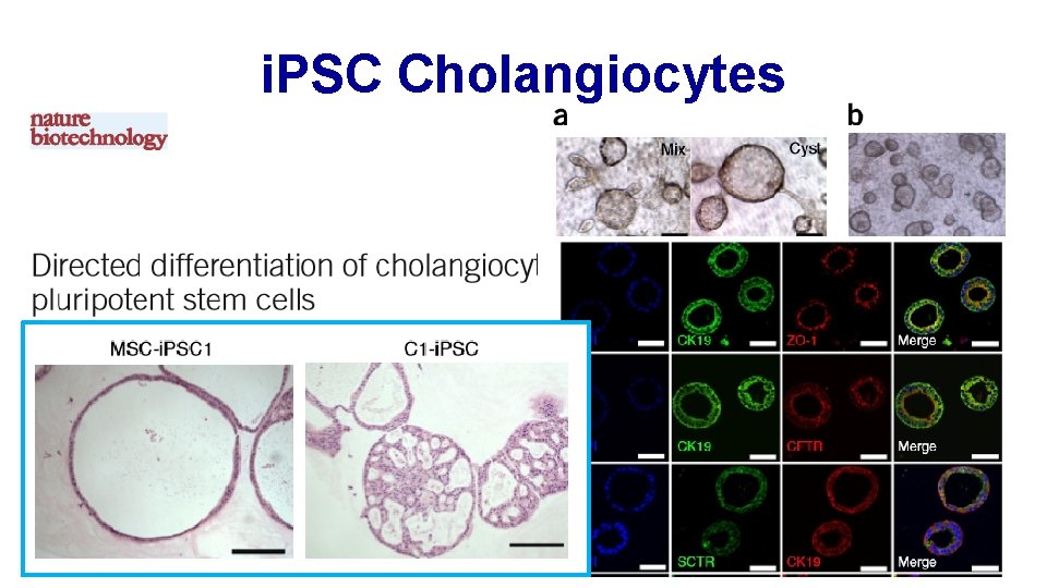 i. PSC Cholangiocytes 