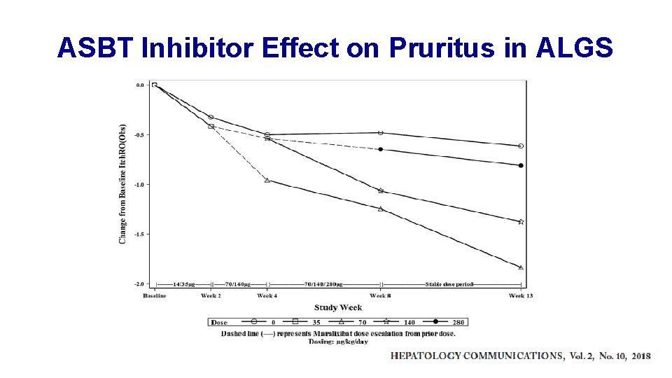 ASBT Inhibitor Effect on Pruritus in ALGS 