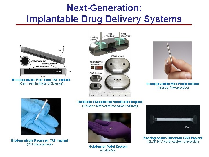 Next-Generation: Implantable Drug Delivery Systems Nondegradable Pod-Type TAF Implant (Oak Crest Institute of Science)