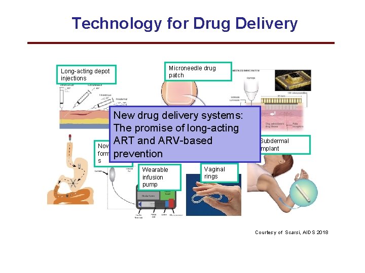 Technology for Drug Delivery Long-acting depot injections Microneedle drug patch New drug delivery systems:
