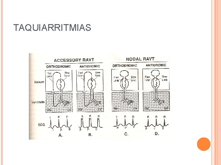 TAQUIARRITMIAS 