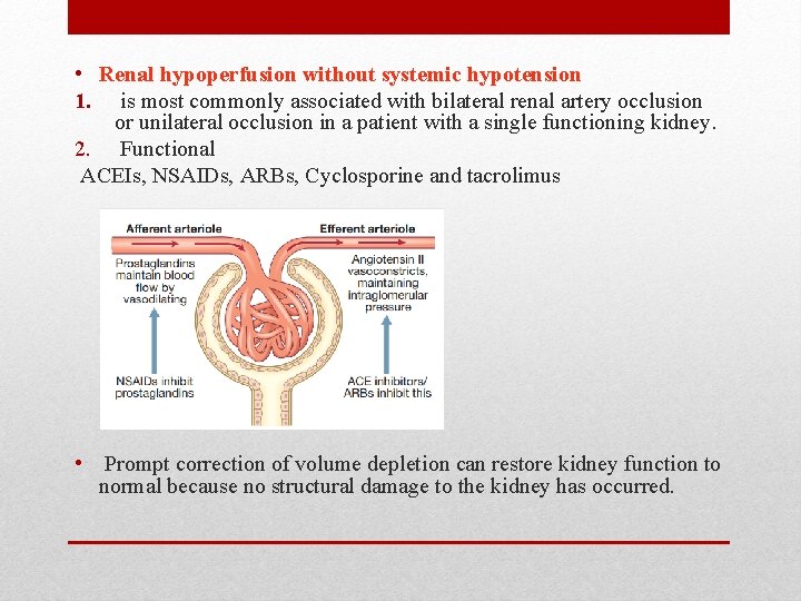 • Renal hypoperfusion without systemic hypotension 1. is most commonly associated with bilateral • Renal hypoperfusion without systemic hypotension 1. is most commonly associated with bilateral