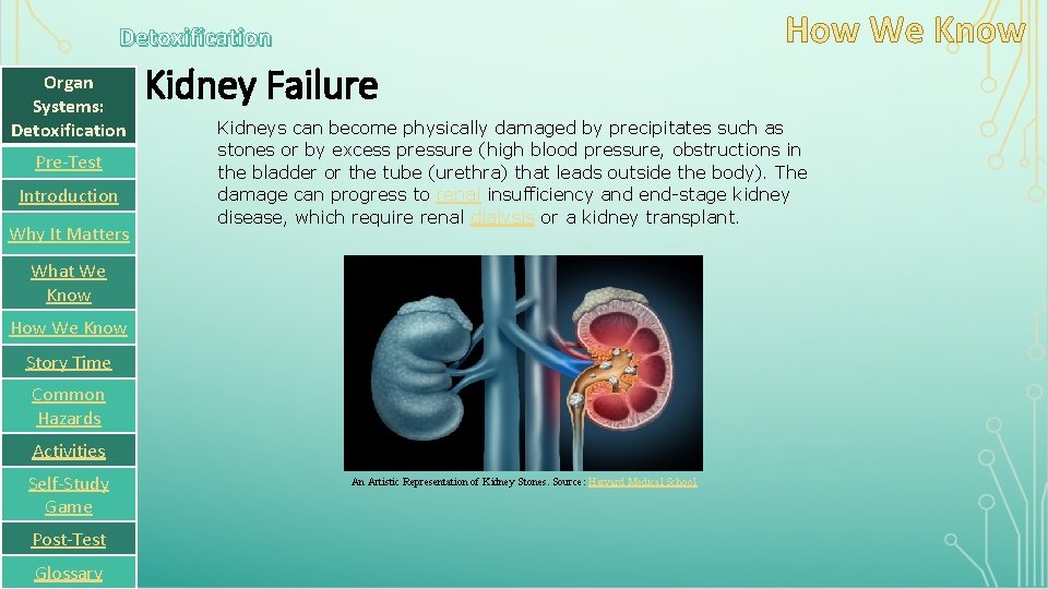 Detoxification Organ Systems: Detoxification Pre-Test Introduction Why It Matters Kidney Failure Kidneys can become