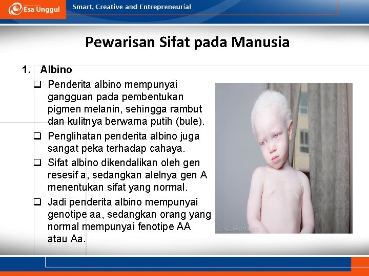 Pewarisan Sifat pada Manusia 1. Albino q Penderita albino mempunyai gangguan pada pembentukan pigmen