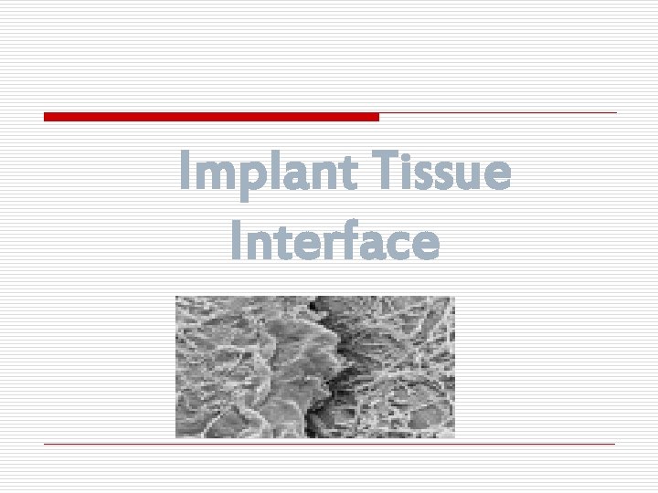 Implant Tissue Interface 
