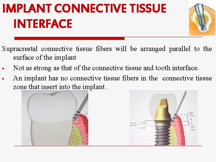 IMPLANT CONNECTIVE TISSUE INTERFACE Supracrestal connective tissue fibers will be arranged parallel to the