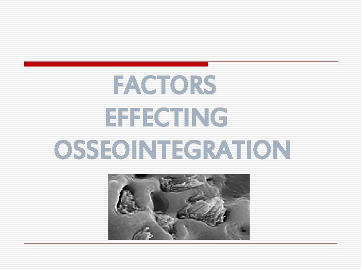FACTORS EFFECTING OSSEOINTEGRATION 