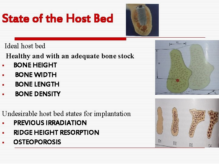 State of the Host Bed Ideal host bed Healthy and with an adequate bone