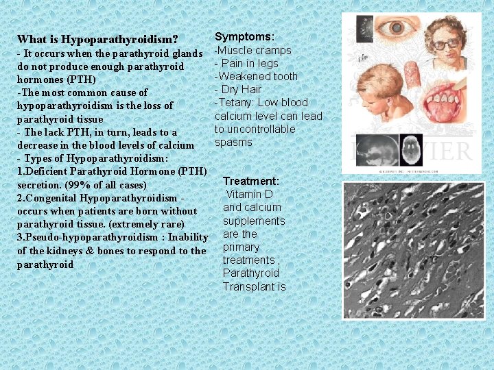 What is Hypoparathyroidism? - It occurs when the parathyroid glands do not produce enough