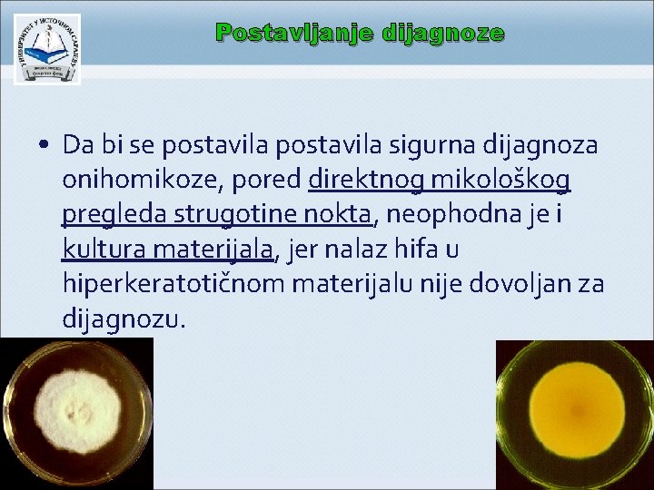 Postavljanje dijagnoze • Da bi se postavila sigurna dijagnoza onihomikoze, pored direktnog mikološkog pregleda