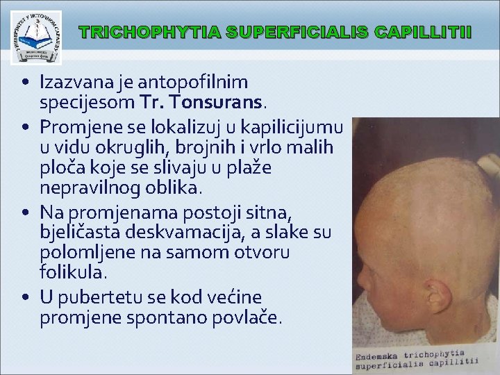 TRICHOPHYTIA SUPERFICIALIS CAPILLITII • Izazvana je antopofilnim specijesom Tr. Tonsurans. • Promjene se lokalizuj