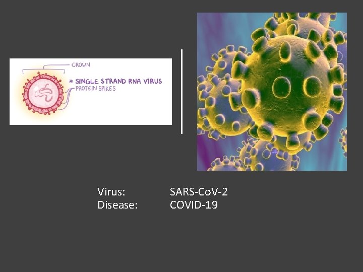 Virus: Disease: SARS-Co. V-2 COVID-19 