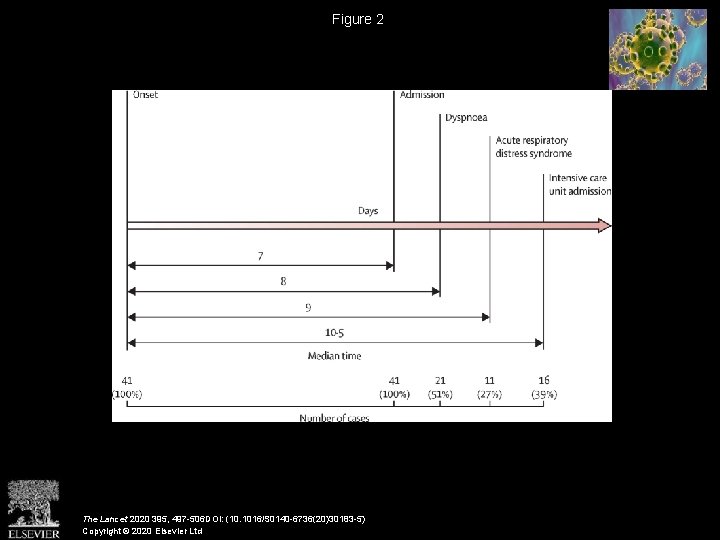 Figure 2 The Lancet 2020 395, 497 -506 DOI: (10. 1016/S 0140 -6736(20)30183 -5)