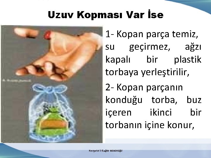 Uzuv Kopması Var İse 1 - Kopan parça temiz, su geçirmez, ağzı kapalı bir