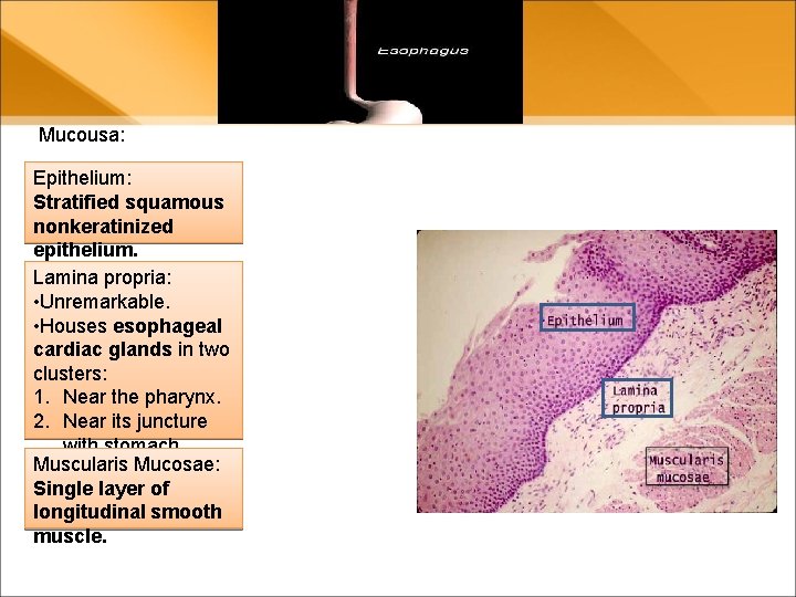 Mucousa: Epithelium: Stratified squamous nonkeratinized epithelium. Lamina propria: • Unremarkable. • Houses esophageal cardiac Mucousa: Epithelium: Stratified squamous nonkeratinized epithelium. Lamina propria: • Unremarkable. • Houses esophageal cardiac