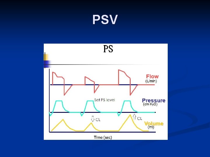 PSV 