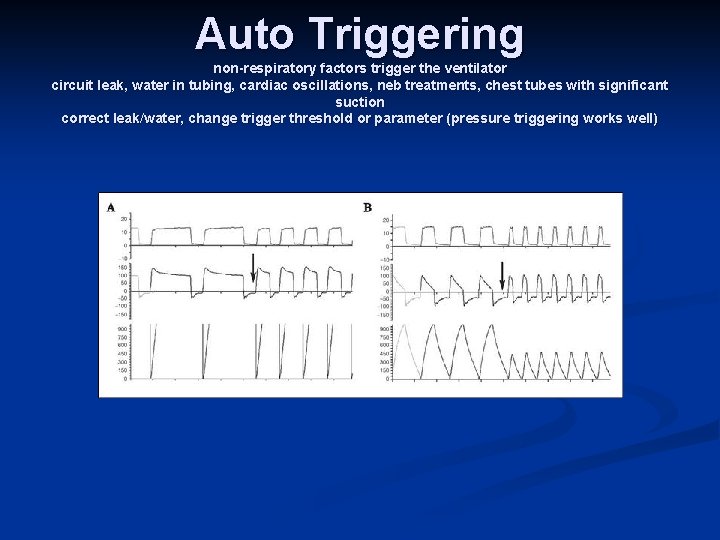 Auto Triggering non-respiratory factors trigger the ventilator circuit leak, water in tubing, cardiac oscillations,