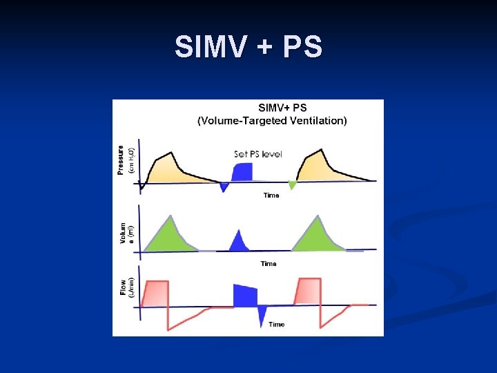SIMV + PS 