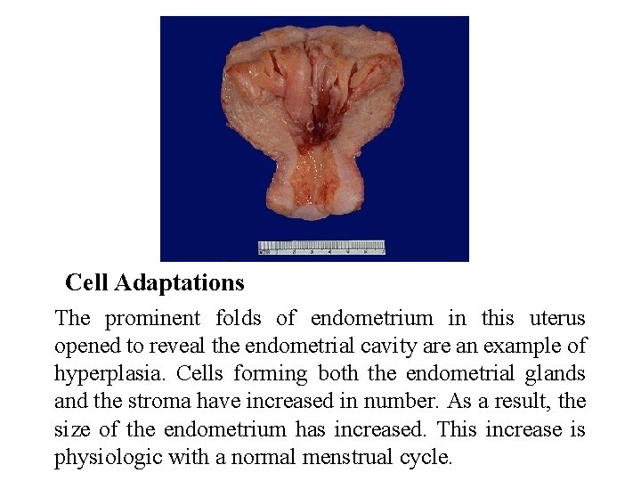 Cell Adaptations The prominent folds of endometrium in this uterus opened to reveal the