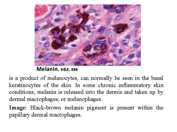 Melanin. H&E, 388 is a product of melanocytes, can normally be seen in the
