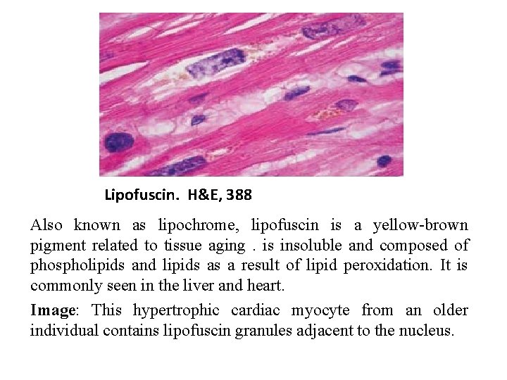 Lipofuscin. H&E, 388 Also known as lipochrome, lipofuscin is a yellow-brown pigment related to