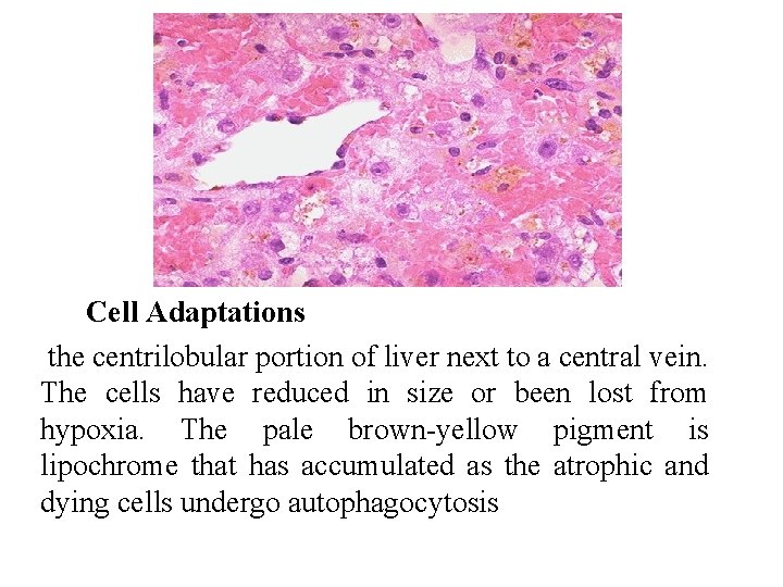Cell Adaptations the centrilobular portion of liver next to a central vein. The cells