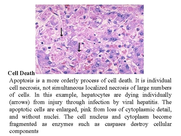 Cell Death Apoptosis is a more orderly process of cell death. It is individual