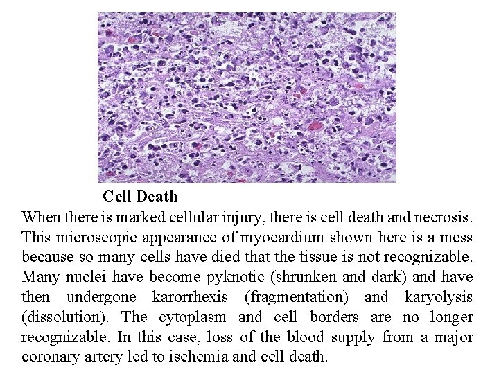Cell Death When there is marked cellular injury, there is cell death and necrosis.