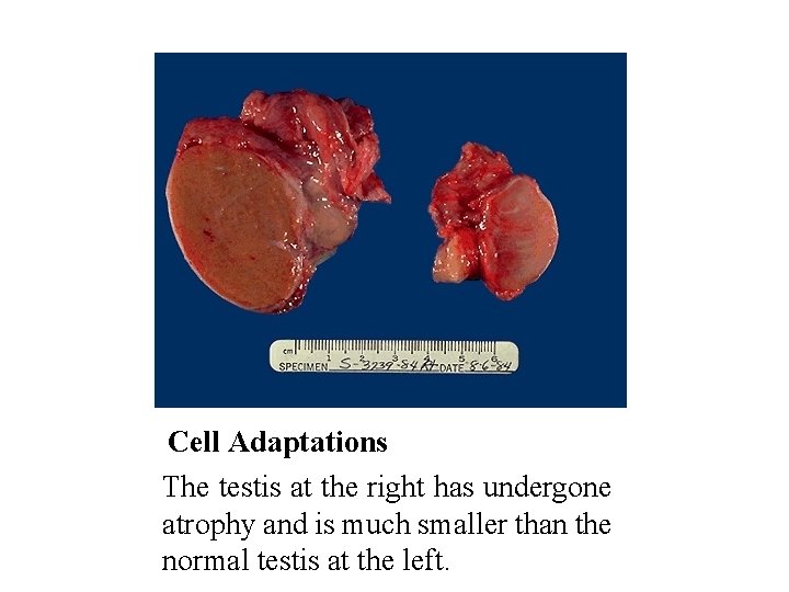 Cell Adaptations The testis at the right has undergone atrophy and is much smaller