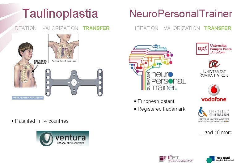 Taulinoplastia IDEATION VALORIZATION TRANSFER Neuro. Personal. Trainer IDEATION VALORIZATION TRANSFER § European patent §