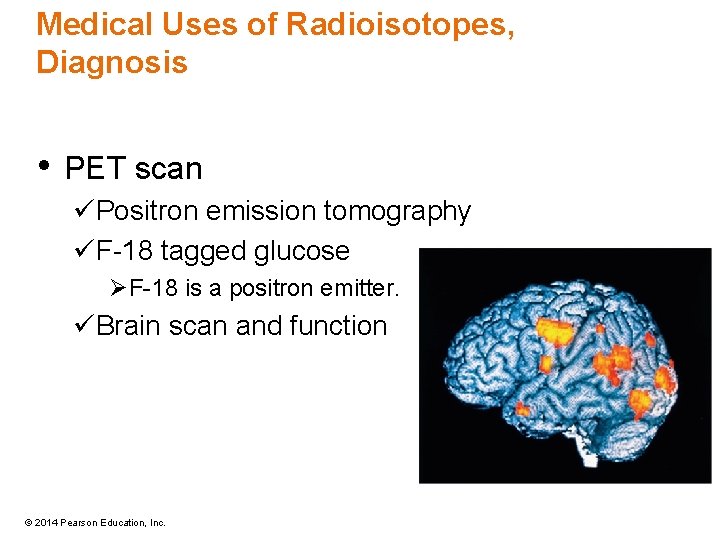 Medical Uses of Radioisotopes, Diagnosis • PET scan üPositron emission tomography üF-18 tagged glucose