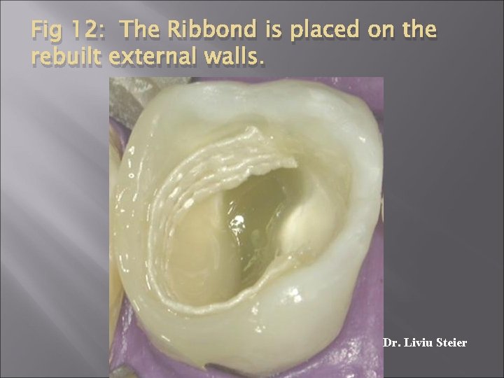 Fig 12: The Ribbond is placed on the rebuilt external walls. Dr. Liviu Steier