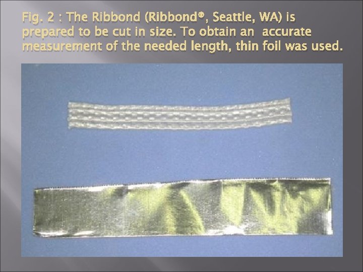 Fig. 2 : The Ribbond (Ribbond®, Seattle, WA) is prepared to be cut in